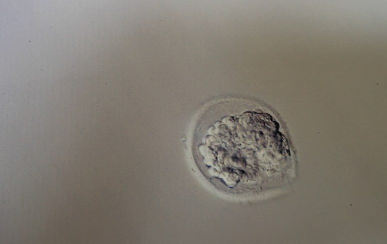 Blastocyst